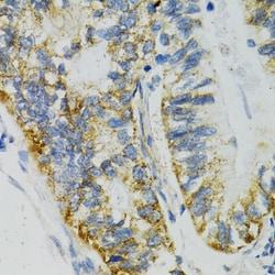 Invitrogen SLC27A2 Polyclonal Antibody 100 &mu;L; Unconjugated:Antibodies,