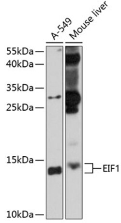 Invitrogen eIF1 Polyclonal Antibody 100 &mu;L; Unconjugated:Antibodies,