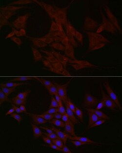 Invitrogen NTF4 Polyclonal Antibody 100 &mu;L; Unconjugated:Antibodies,