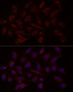 Invitrogen NTF4 Polyclonal Antibody 100 &mu;L; Unconjugated:Antibodies,