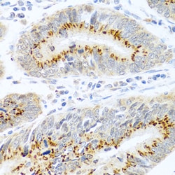 Invitrogen FAM3B Polyclonal Antibody 100 &mu;L; Unconjugated:Antibodies,