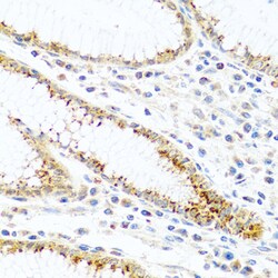 Invitrogen FAM3B Polyclonal Antibody 100 &mu;L; Unconjugated:Antibodies,