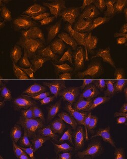 Invitrogen SDHB Polyclonal Antibody 100 &mu;L; Unconjugated:Antibodies,