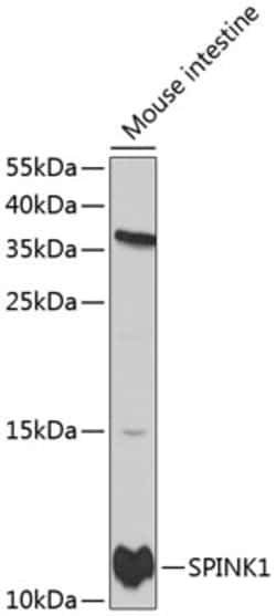 Invitrogen SPINK1 Polyclonal Antibody 100 &mu;L; Unconjugated:Antibodies,