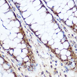 Invitrogen Cyclin D1 Polyclonal Antibody 100 μL; Unconjugated:Antibodies,