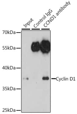 Invitrogen Cyclin D1 Polyclonal Antibody 100 μL; Unconjugated:Antibodies,