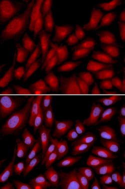 Invitrogen BAG1 Polyclonal Antibody 100 &mu;L; Unconjugated:Antibodies,