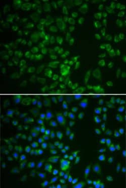 DMP1 Polyclonal Antibody, Invitrogen 100 &mu;L; Unconjugated:Antibodies,