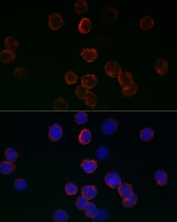 Invitrogen GPX1 Polyclonal Antibody 100 &mu;L; Unconjugated:Antibodies,