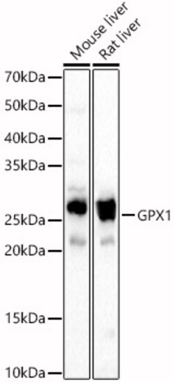 Invitrogen GPX1 Polyclonal Antibody 100 &mu;L; Unconjugated:Antibodies,