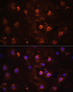 Invitrogen IL-1 beta Polyclonal Antibody 100 &mu;L | Buy Online | Invitrogen&trade; | Fisher Scientific
