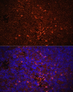 Invitrogen IL-1 beta Polyclonal Antibody 100 &mu;L | Buy Online | Invitrogen&trade; | Fisher Scientific