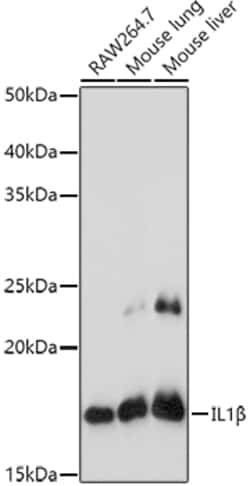 Invitrogen IL-1 beta Polyclonal Antibody 100 &mu;L | Buy Online | Invitrogen&trade; | Fisher Scientific