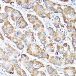 Invitrogen Nrf2 Polyclonal Antibody 100 &mu;L | Buy Online | Invitrogen&trade; | Fisher Scientific