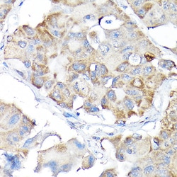 Invitrogen Nrf2 Polyclonal Antibody 100 &mu;L | Buy Online | Invitrogen&trade; | Fisher Scientific