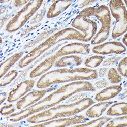 Invitrogen Nrf2 Polyclonal Antibody 100 &mu;L | Buy Online | Invitrogen&trade; | Fisher Scientific