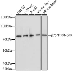 Invitrogen NGF Receptor Polyclonal Antibody 100 &mu;L; Unconjugated:Antibodies,