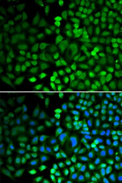 Invitrogen APE1 Polyclonal Antibody 100 &mu;L; Unconjugated:Antibodies,