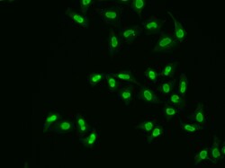 Invitrogen APE1 Polyclonal Antibody 100 &mu;L; Unconjugated:Antibodies,