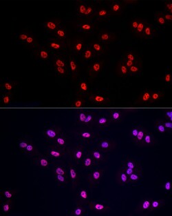 Invitrogen POLR2A Polyclonal Antibody 100 &mu;L; Unconjugated:Antibodies,