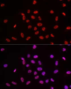 Invitrogen POLR2A Polyclonal Antibody 100 &mu;L; Unconjugated:Antibodies,