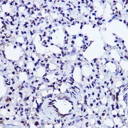 Invitrogen POLR2A Polyclonal Antibody 100 &mu;L; Unconjugated:Antibodies,