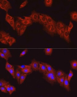Invitrogen FAK Polyclonal Antibody 100 &mu;L; Unconjugated:Antibodies,