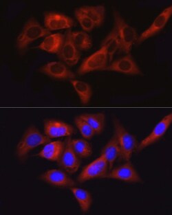 Invitrogen FAK Polyclonal Antibody 100 &mu;L; Unconjugated:Antibodies,
