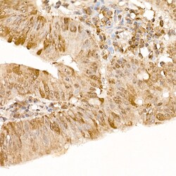 Invitrogen FAK Polyclonal Antibody 100 &mu;L; Unconjugated:Antibodies,