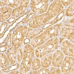 Invitrogen FAK Polyclonal Antibody 100 &mu;L; Unconjugated:Antibodies,