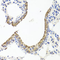 Invitrogen Transthyretin Polyclonal Antibody 100 &mu;L; Unconjugated:Antibodies,