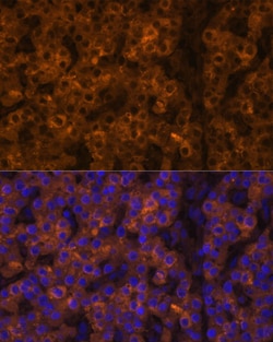 Invitrogen Transthyretin Polyclonal Antibody 100 &mu;L; Unconjugated:Antibodies,