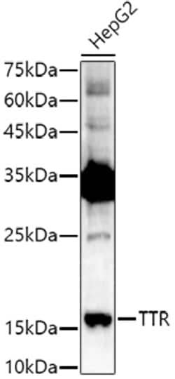 Invitrogen Transthyretin Polyclonal Antibody 100 &mu;L; Unconjugated:Antibodies,