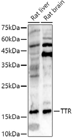Invitrogen Transthyretin Polyclonal Antibody 100 &mu;L; Unconjugated:Antibodies,
