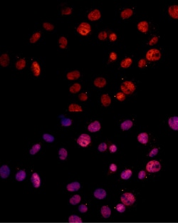 Invitrogen MSH2 Polyclonal Antibody 100 &mu;L; Unconjugated:Antibodies,