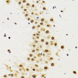 p53 Polyclonal Antibody:Antibodies, Polyclonal