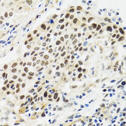 p53 Polyclonal Antibody:Antibodies, Polyclonal