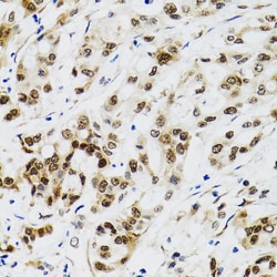 p53 Polyclonal Antibody:Antibodies, Polyclonal