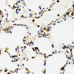 p53 Polyclonal Antibody:Antibodies, Polyclonal