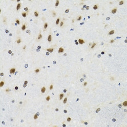 p53 Polyclonal Antibody:Antibodies, Polyclonal