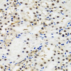 p53 Polyclonal Antibody:Antibodies, Polyclonal