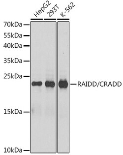 RAIDD Polyclonal Antibody:Antibodies, Polyclonal