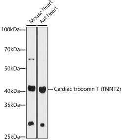 Invitrogen Cardiac Troponin T Polyclonal Antibody 100 &mu;L | Buy Online | Invitrogen&trade; | Fisher Scientific