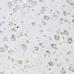 Invitrogen LC3B Polyclonal Antibody 100 &mu;L; Unconjugated:Antibodies,