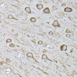 Invitrogen LC3B Polyclonal Antibody 100 &mu;L; Unconjugated:Antibodies,