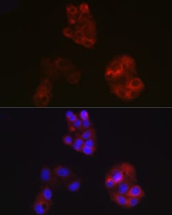 Invitrogen ApoA1 Polyclonal Antibody 100 &mu;L; Unconjugated:Antibodies,