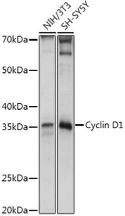 Cyclin D1 Polyclonal Antibody, Invitrogen 100 &mu;L; Unconjugated:Antibodies,