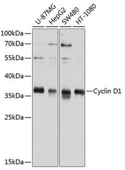 Cyclin D1 Polyclonal Antibody, Invitrogen 100 &mu;L; Unconjugated:Antibodies,