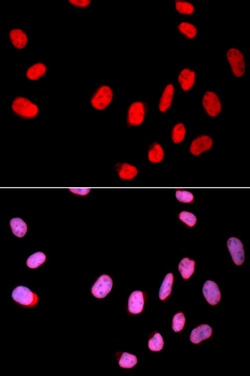 Invitrogen Cdc25C Polyclonal Antibody 100 &mu;L; Unconjugated:Antibodies,