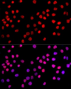 Invitrogen c-Jun Polyclonal Antibody 100 &mu;L; Unconjugated:Antibodies,